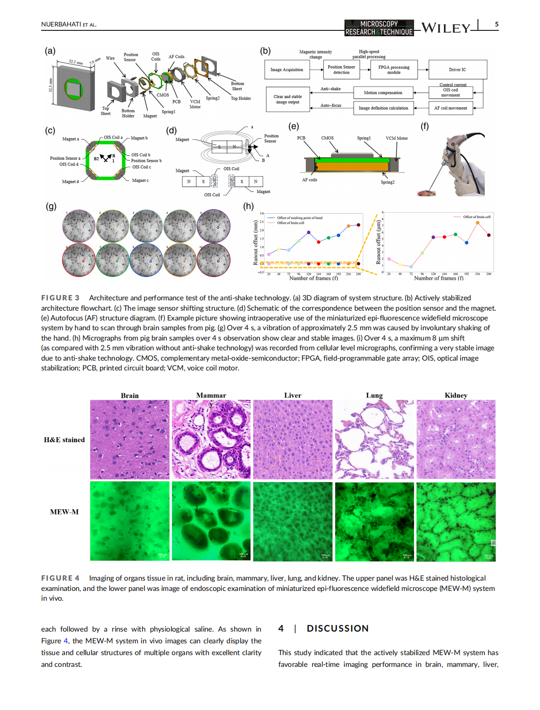 An actively stabilized, miniaturized epi-fluorescence widefield microscope for real-time observation in vivo(圖5)