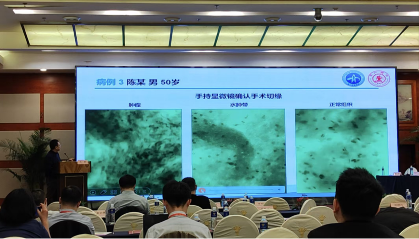 昆明神經(jīng)腫瘤論壇：EndoSCell?細胞級熒光導(dǎo)引技術(shù)開啟精準手術(shù)新時代(圖5)