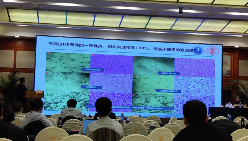 昆明神經(jīng)腫瘤論壇：EndoSCell?細胞級熒光導(dǎo)引技術(shù)開啟精準手術(shù)新時代(圖4)